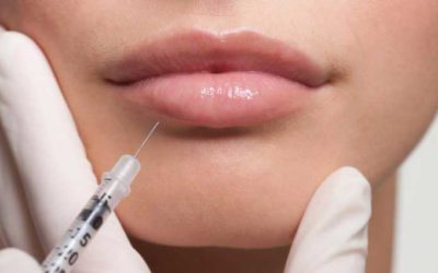 Neurotoxins Versus Fillers: What’s Right for Me?