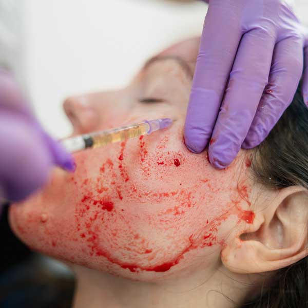 Don’t be Spooked by a Vampire Facial!