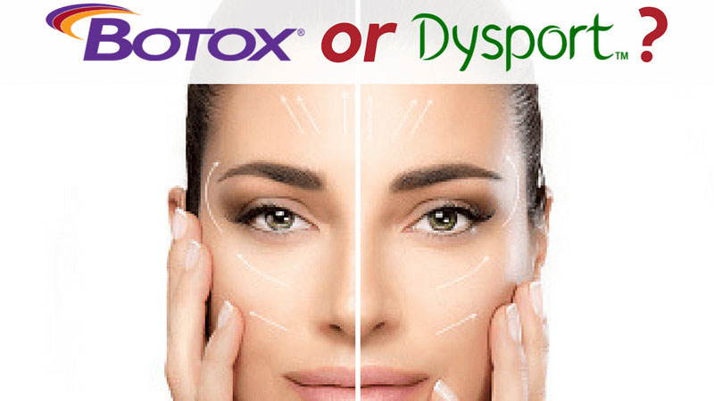 botox-vs-dysport