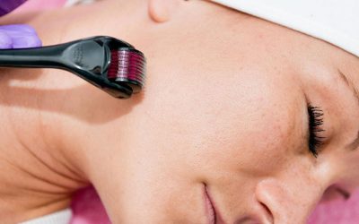 Benefits and Side Effects of Microneedling