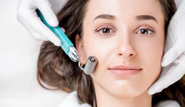 Microneedling-northern-kentucky