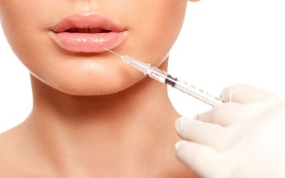 The Side Effects of Lip Fillers: What to Expect