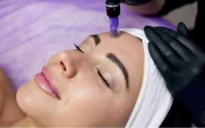 What you need to know about Microneedling